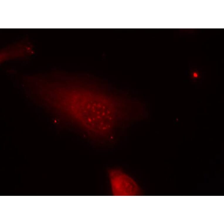 Immunofluorescence - FKHR (Phospho-Ser319) Antibody from Signalway Antibody (11136) - Antibodies.com
