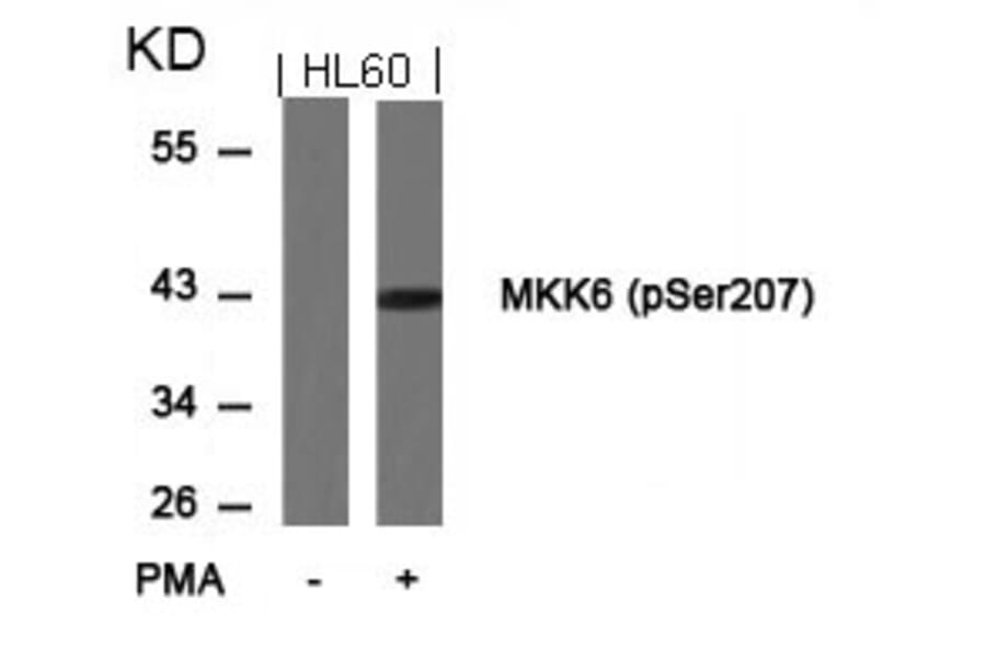 Western blot - MKK6 (Phospho-Ser207) Antibody from Signalway Antibody (11146) - Antibodies.com