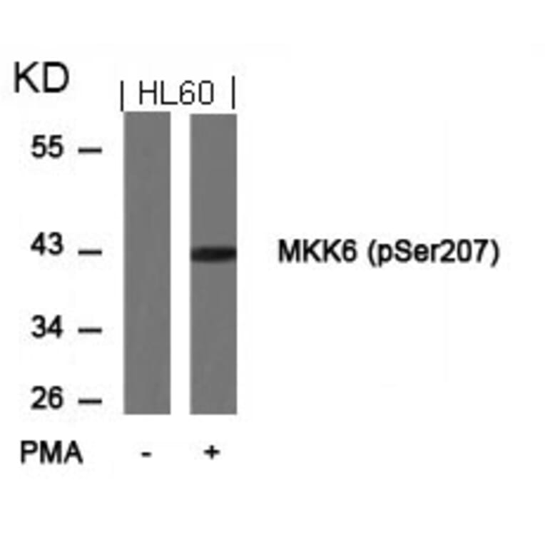 Western blot - MKK6 (Phospho-Ser207) Antibody from Signalway Antibody (11146) - Antibodies.com