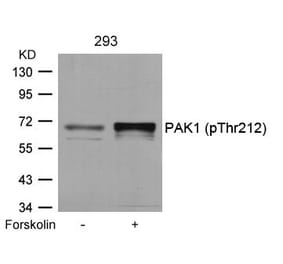 Western blot - PAK1 (Phospho-Thr212) Antibody from Signalway Antibody (11154) - Antibodies.com