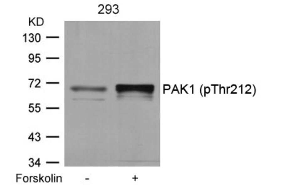 Western blot - PAK1 (Phospho-Thr212) Antibody from Signalway Antibody (11154) - Antibodies.com