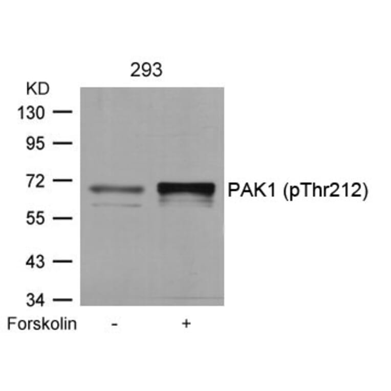 Western blot - PAK1 (Phospho-Thr212) Antibody from Signalway Antibody (11154) - Antibodies.com