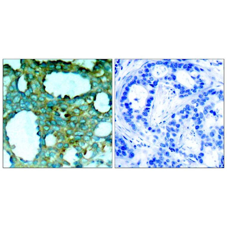 Immunohistochemistry - PAK1 (Phospho-Thr212) Antibody from Signalway Antibody (11154) - Antibodies.com