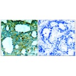 Immunohistochemistry - PAK1 (Phospho-Thr212) Antibody from Signalway Antibody (11154) - Antibodies.com