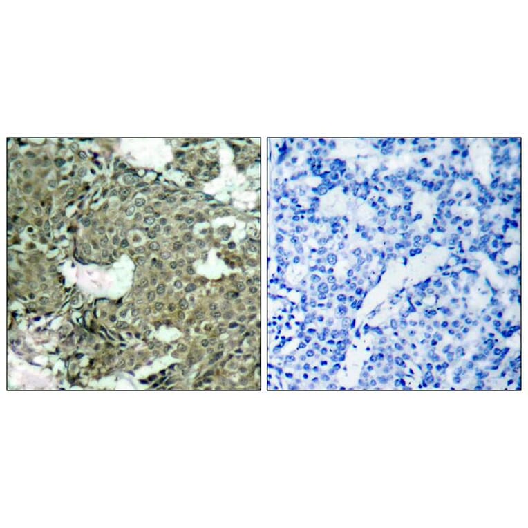 Immunohistochemistry - MEK1 (Phospho-Ser221) Antibody from Signalway Antibody (11161) - Antibodies.com