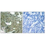 Immunohistochemistry - MEK1 (Phospho-Ser221) Antibody from Signalway Antibody (11161) - Antibodies.com