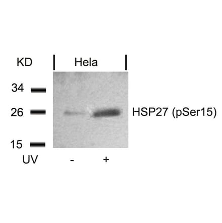Western blot - HSP27 (Phospho-Ser15) Antibody from Signalway Antibody (11164) - Antibodies.com