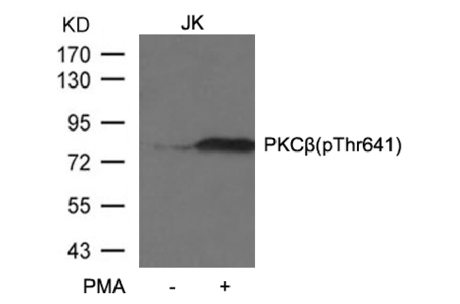 Western blot - PKCb (Phospho-Thr641) Antibody from Signalway Antibody (11172) - Antibodies.com
