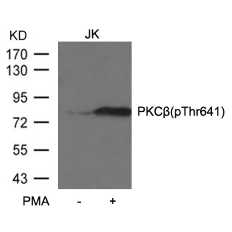 Western blot - PKCb (Phospho-Thr641) Antibody from Signalway Antibody (11172) - Antibodies.com