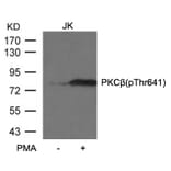 Western blot - PKCb (Phospho-Thr641) Antibody from Signalway Antibody (11172) - Antibodies.com