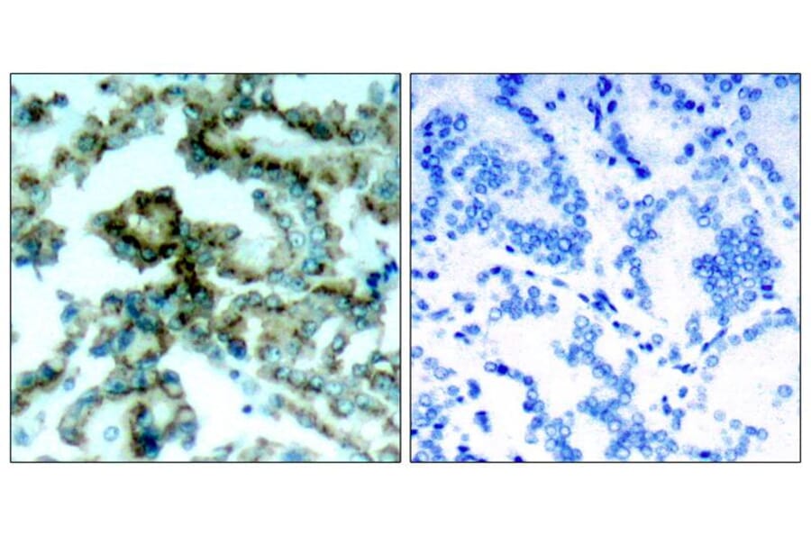 Immunohistochemistry - PKCb (Phospho-Thr641) Antibody from Signalway Antibody (11172) - Antibodies.com