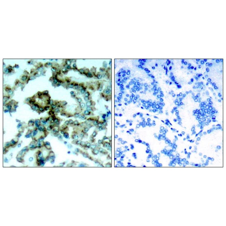 Immunohistochemistry - PKCb (Phospho-Thr641) Antibody from Signalway Antibody (11172) - Antibodies.com