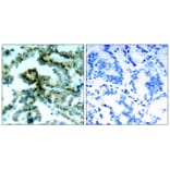 Immunohistochemistry - PKCb (Phospho-Thr641) Antibody from Signalway Antibody (11172) - Antibodies.com