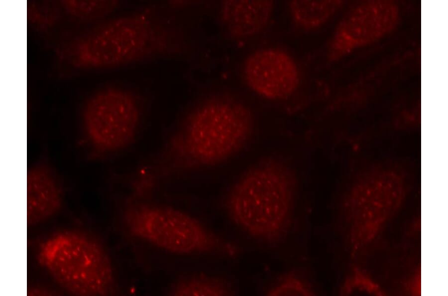 Immunofluorescence - PKCb (Phospho-Thr641) Antibody from Signalway Antibody (11172) - Antibodies.com