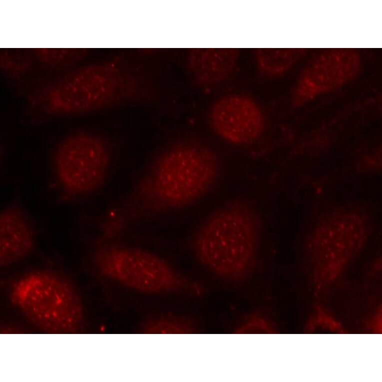 Immunofluorescence - PKCb (Phospho-Thr641) Antibody from Signalway Antibody (11172) - Antibodies.com