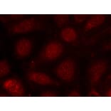 Immunofluorescence - PKCb (Phospho-Thr641) Antibody from Signalway Antibody (11172) - Antibodies.com