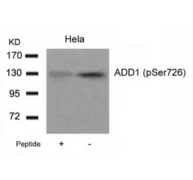 Western blot - ADD1 (Phospho-Ser726) Antibody from Signalway Antibody (11182) - Antibodies.com