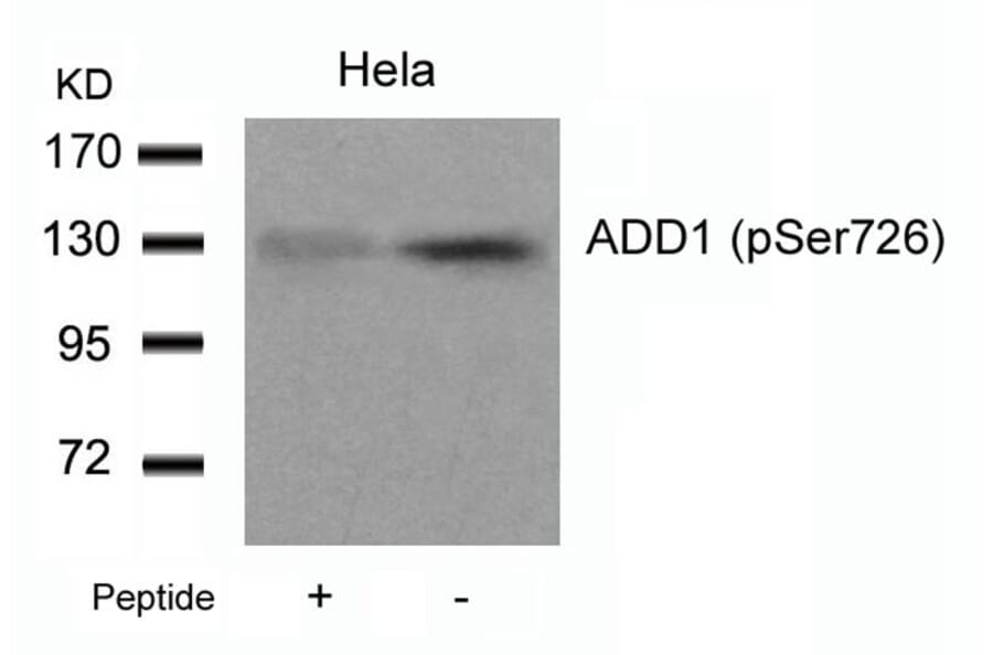 Western blot - ADD1 (Phospho-Ser726) Antibody from Signalway Antibody (11182) - Antibodies.com