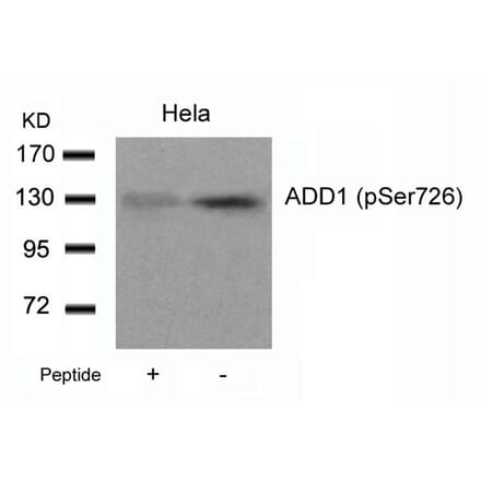 Western blot - ADD1 (Phospho-Ser726) Antibody from Signalway Antibody (11182) - Antibodies.com