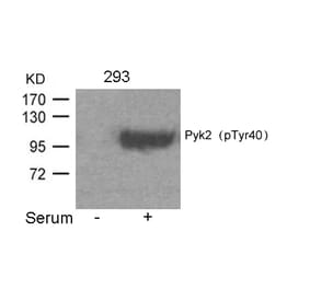 Western blot - Pyk2 (Phospho-Tyr402) Antibody from Signalway Antibody (11216) - Antibodies.com