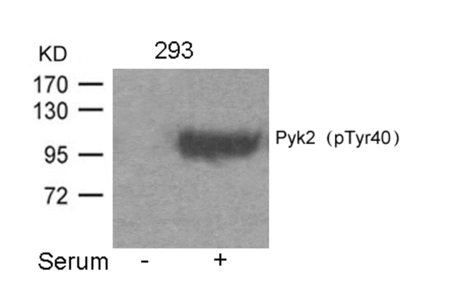 Western blot - Pyk2 (Phospho-Tyr402) Antibody from Signalway Antibody (11216) - Antibodies.com