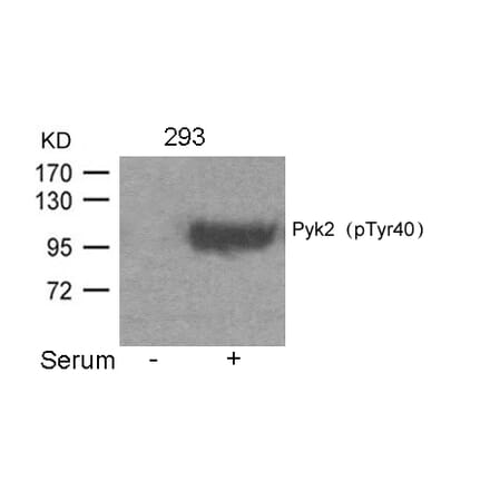 Western blot - Pyk2 (Phospho-Tyr402) Antibody from Signalway Antibody (11216) - Antibodies.com
