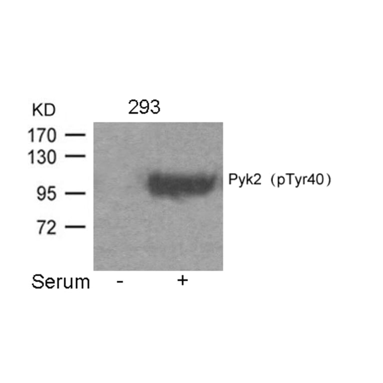 Western blot - Pyk2 (Phospho-Tyr402) Antibody from Signalway Antibody (11216) - Antibodies.com