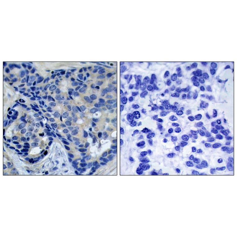 Immunohistochemistry - Pyk2 (Phospho-Tyr402) Antibody from Signalway Antibody (11216) - Antibodies.com