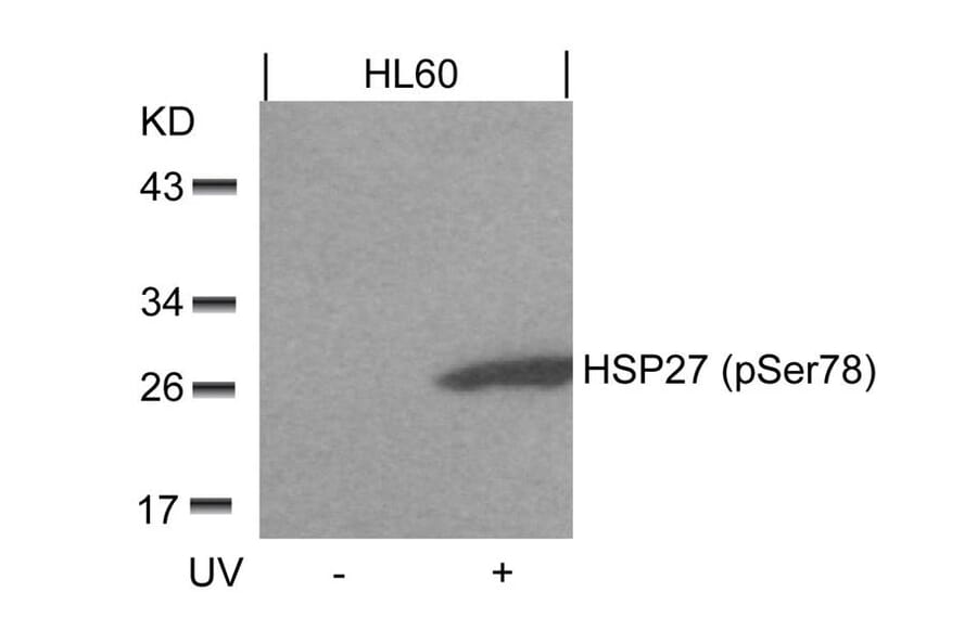 Western blot - HSP27 (Phospho-Ser78) Antibody from Signalway Antibody (11247) - Antibodies.com