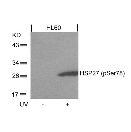 Western blot - HSP27 (Phospho-Ser78) Antibody from Signalway Antibody (11247) - Antibodies.com