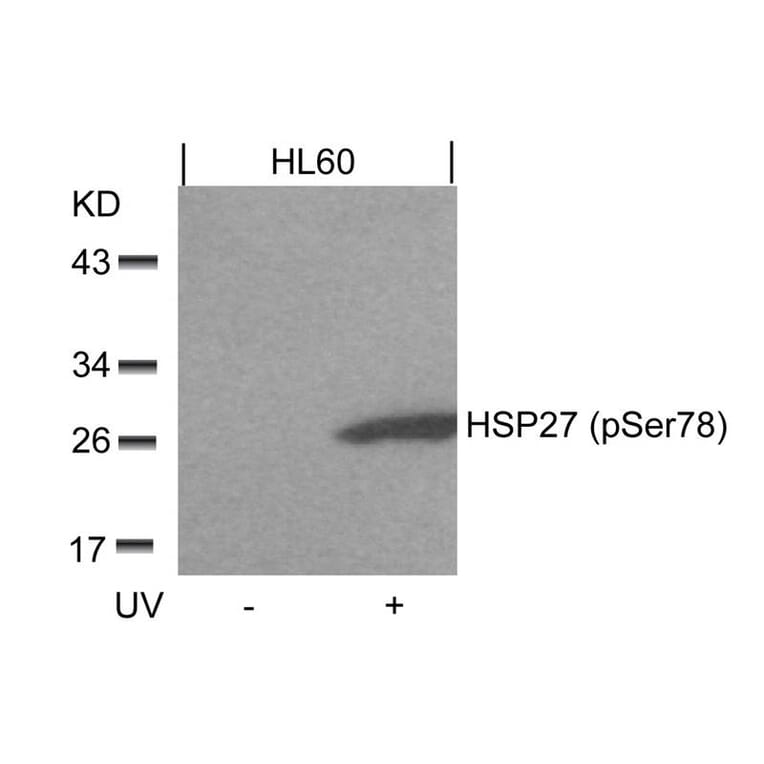 Western blot - HSP27 (Phospho-Ser78) Antibody from Signalway Antibody (11247) - Antibodies.com