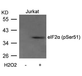 Western blot - eIF2a (Phospho-Ser51) Antibody from Signalway Antibody (11279) - Antibodies.com