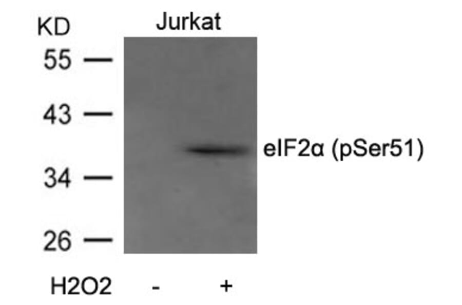 Western blot - eIF2a (Phospho-Ser51) Antibody from Signalway Antibody (11279) - Antibodies.com