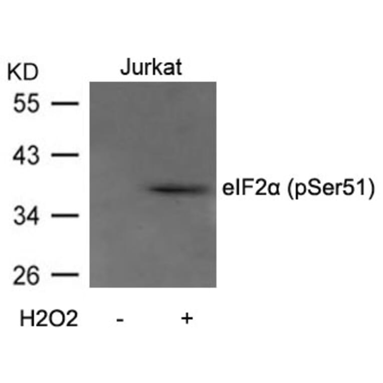 Western blot - eIF2a (Phospho-Ser51) Antibody from Signalway Antibody (11279) - Antibodies.com