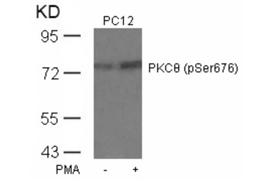 Western blot - PKCth (Phospho-Ser676) Antibody from Signalway Antibody (11297) - Antibodies.com