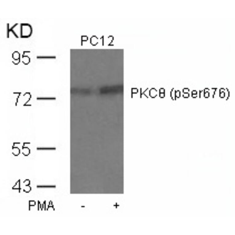 Western blot - PKCth (Phospho-Ser676) Antibody from Signalway Antibody (11297) - Antibodies.com
