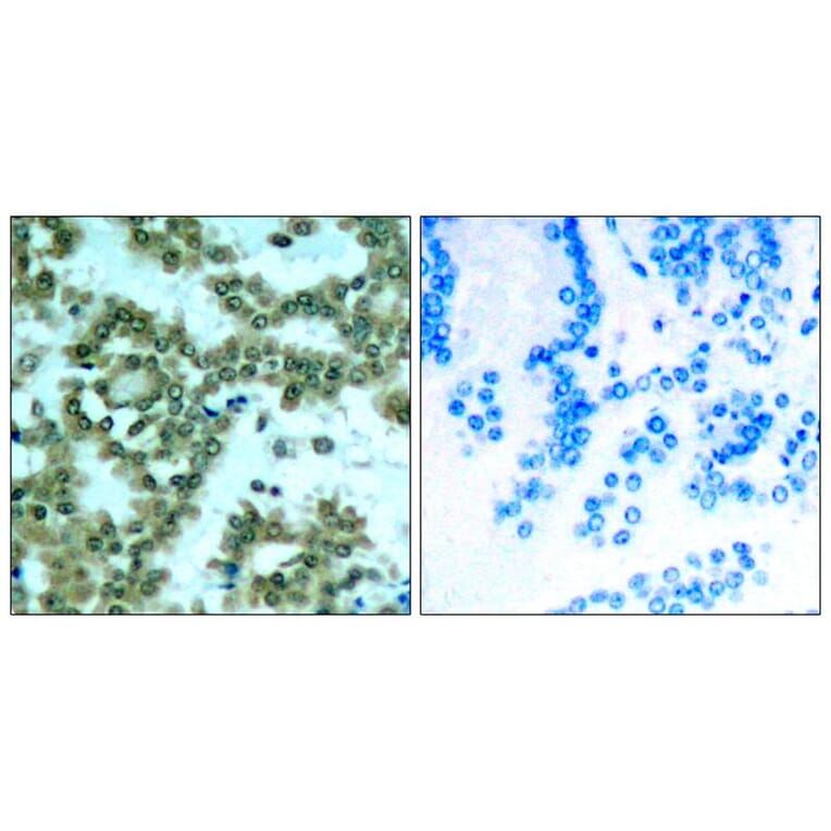 Immunohistochemistry - PKCth (Phospho-Ser676) Antibody from Signalway Antibody (11297) - Antibodies.com