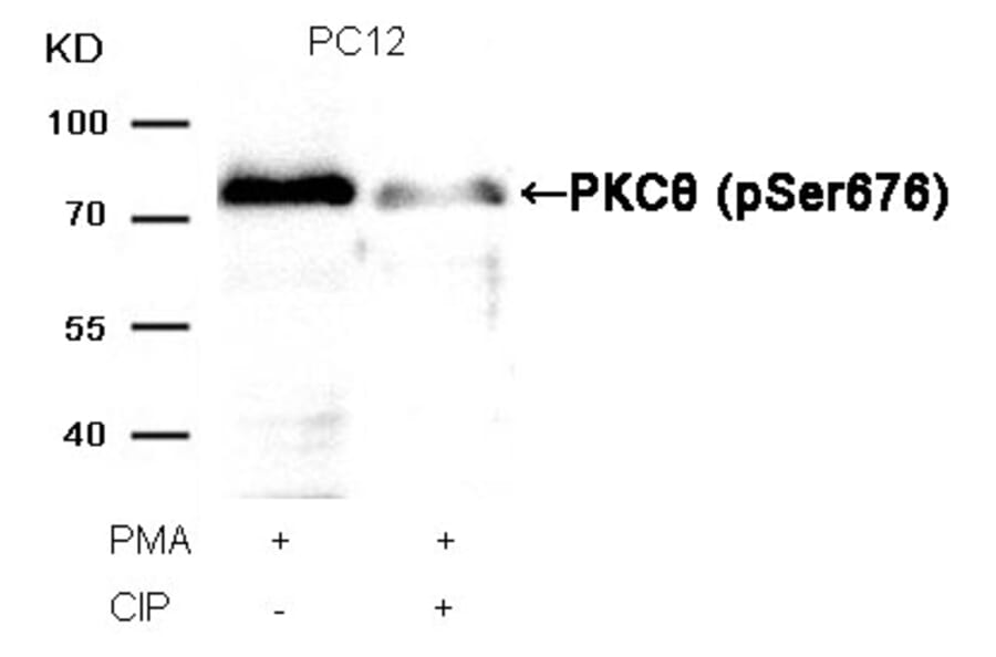 Western blot - PKCth (Phospho-Ser676) Antibody from Signalway Antibody (11297) - Antibodies.com