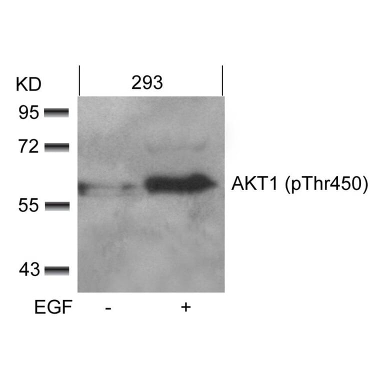 Western blot - AKT1 (phospho-Thr450) Antibody from Signalway Antibody (11502) - Antibodies.com