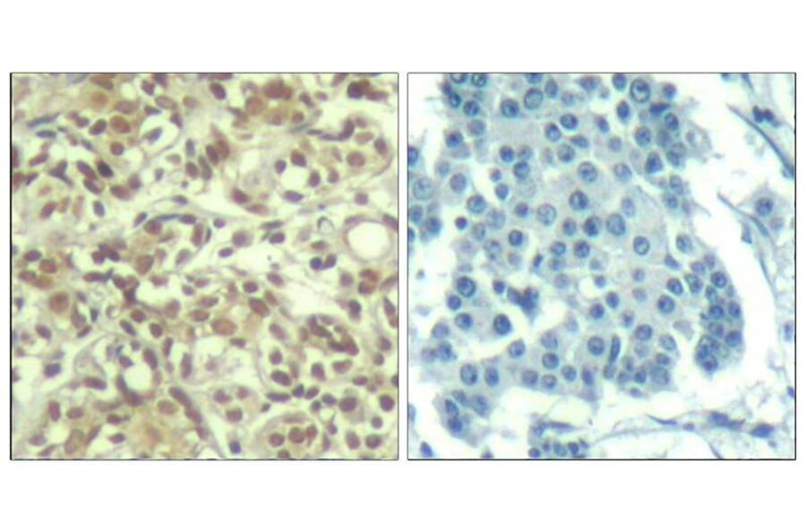 Immunohistochemistry - AKT1 (phospho-Thr450) Antibody from Signalway Antibody (11502) - Antibodies.com
