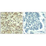 Immunohistochemistry - AKT1 (phospho-Thr450) Antibody from Signalway Antibody (11502) - Antibodies.com