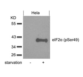 Western blot - eIF2a (phospho-Ser49) Antibody from Signalway Antibody (11511) - Antibodies.com