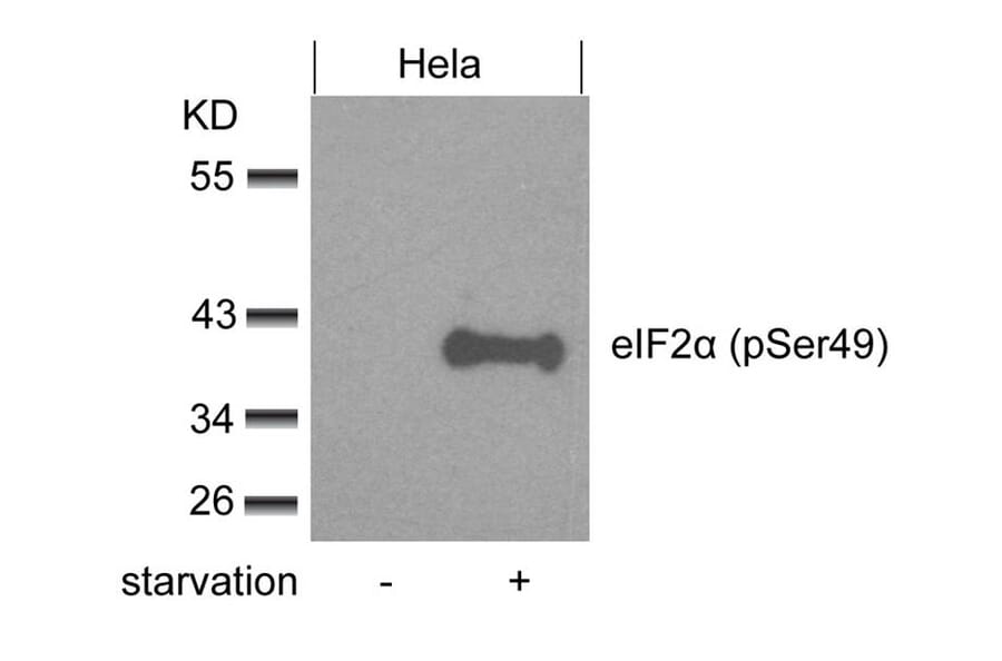 Western blot - eIF2a (phospho-Ser49) Antibody from Signalway Antibody (11511) - Antibodies.com