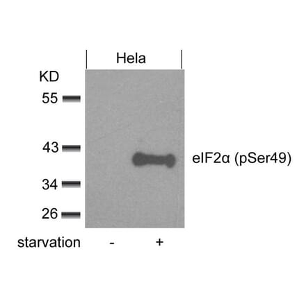 Western blot - eIF2a (phospho-Ser49) Antibody from Signalway Antibody (11511) - Antibodies.com