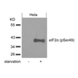 Western blot - eIF2a (phospho-Ser49) Antibody from Signalway Antibody (11511) - Antibodies.com