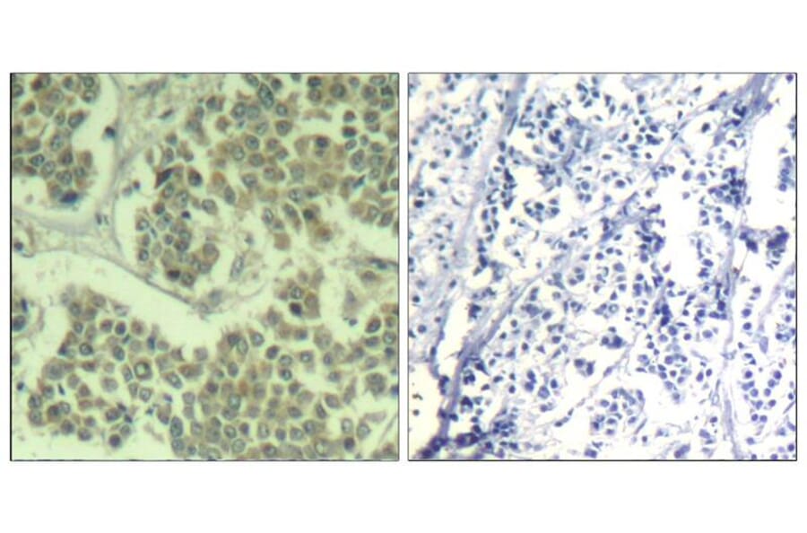 Immunohistochemistry - eIF2a (phospho-Ser49) Antibody from Signalway Antibody (11511) - Antibodies.com
