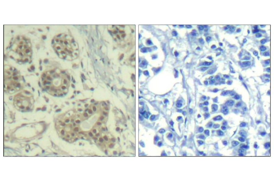 Immunohistochemistry - MDM2 (phospho-Ser166) Antibody from Signalway Antibody (11550) - Antibodies.com
