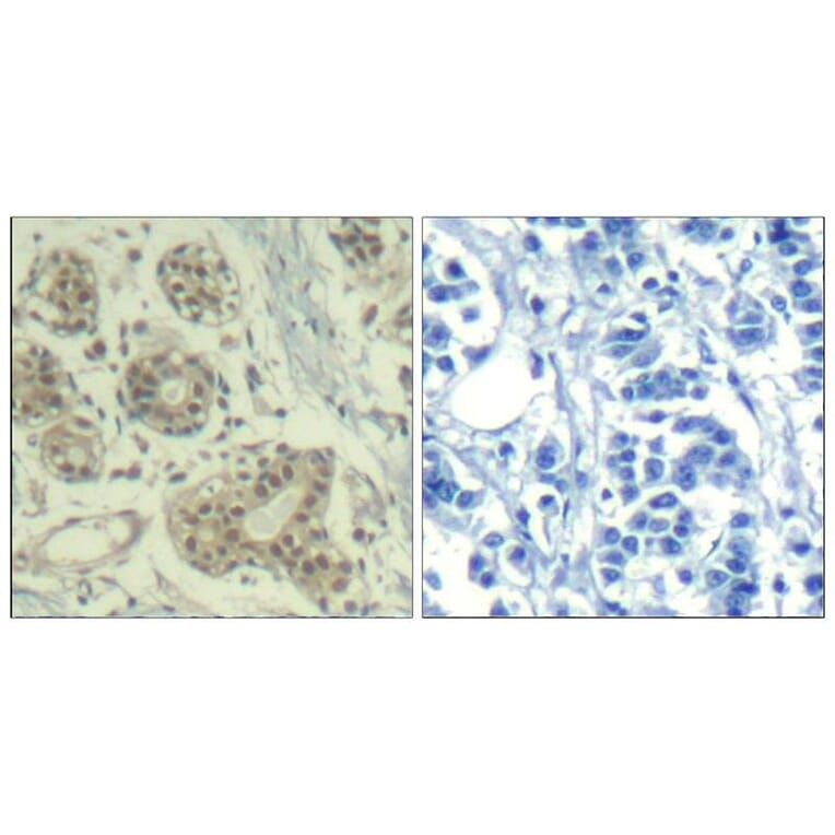 Immunohistochemistry - MDM2 (phospho-Ser166) Antibody from Signalway Antibody (11550) - Antibodies.com
