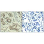 Immunohistochemistry - MDM2 (phospho-Ser166) Antibody from Signalway Antibody (11550) - Antibodies.com