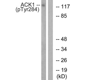 Western blot - ACK1 (Phospho-Tyr284) Antibody from Signalway Antibody (11671) - Antibodies.com